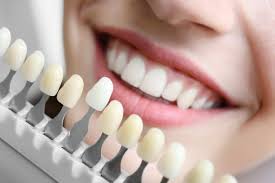 Anand P, Author at Yonge Eglinton Dental
